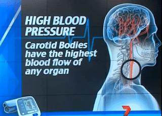 علاج جراحي يقضي علي مرض ارتفاع ضغط الدم نهائياً ! 8