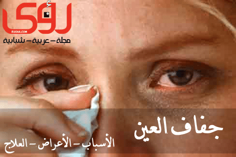 جفاف العين : الأسباب - الأعراض - العلاج 8