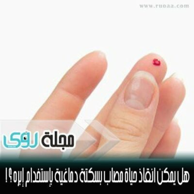 هل يمكن حقاً انقاذ حياة مصاب بالسكتة الدماغية بإستخدام إبره ؟!