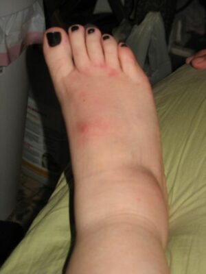 ما الذي يقوله مظهرك عن صحتك ؟ 20