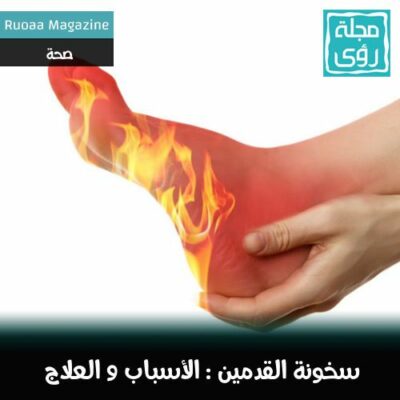 أسباب وعلاج سخونة القدمين 30