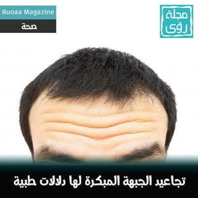 هذا هو ما تقوله تجاعيد الجبهة المبكرة عن صحتك 2