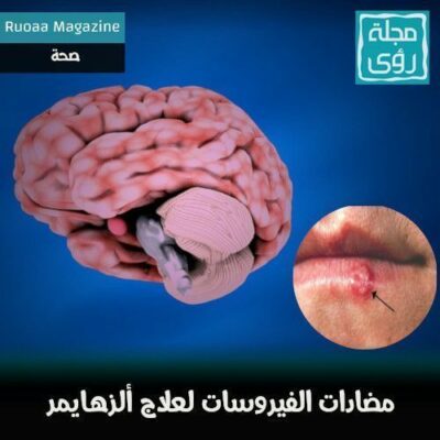 هل يحل فيروس الهربس البسيط لغز ألزهايمر للأبد ؟ 10