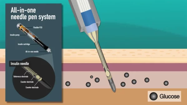 جهازان مبتكران لقياس السكر في الدم وحقن الأنسولين بسهولة 4