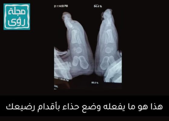 هذا هو ما يفعله ارتداء الرضع للأحذية 4