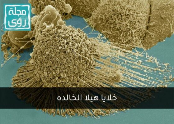خلايا هيلا الخالدة : ماتت هنريتا وبقيت خلاياها حية منذ 70 عاماً 4
